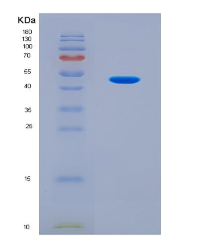 SDS-PAGE analysis of Human PNPLA3 (1-Acylglycerol-3-Phosphate O-Acyltransferase Pnpla3) - Recombinant Protein, CAT# BLT-08695P showing >90% purity under 15% SDS-PAGE (Reduced)Human PNPLA3 (1-Acylglycerol-3-Phosphate O-Acyltransferase Pnpla3) - Recombinant Protein