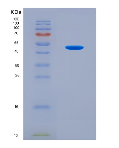 SDS-PAGE analysis of Human PNPLA3 (1-Acylglycerol-3-Phosphate O-Acyltransferase Pnpla3) - Recombinant Protein, CATHuman PNPLA3 (1-Acylglycerol-3-Phosphate O-Acyltransferase Pnpla3) - Recombinant Protein