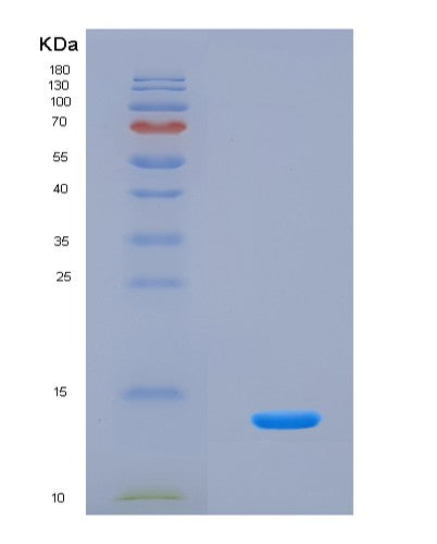 SDS-PAGE analysis of Human SPINK2 (Serine Protease Inhibitor Kazal-Type 2) - Recombinant Protein, CATHuman SPINK2 (Serine Protease Inhibitor Kazal-Type 2) - Recombinant Protein