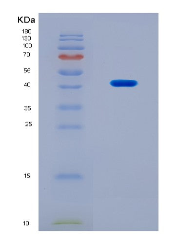 SDS-PAGE analysis of Human NR4A2 (Nuclear Receptor Subfamily 4 Group A Member 2) - Recombinant Protein, CATHuman NR4A2 (Nuclear Receptor Subfamily 4 Group A Member 2) - Recombinant Protein