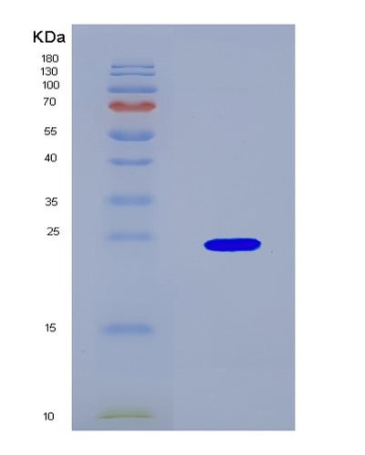 SDS-PAGE analysis of Human CASP4 (Caspase-4) - Recombinant Protein, CAT# BLT-08700P showing >90% purity under 15% SDS-PAGE (Reduced)Human CASP4 (Caspase-4) - Recombinant Protein
