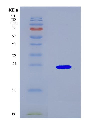 SDS-PAGE analysis of Human CASP4 (Caspase-4) - Recombinant Protein, CATHuman CASP4 (Caspase-4) - Recombinant Protein
