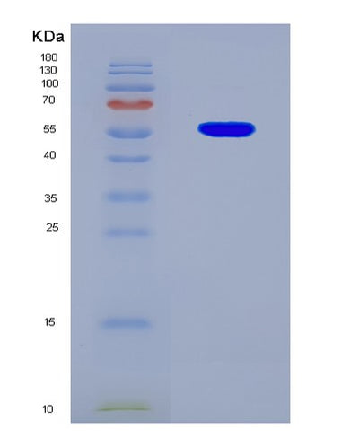 SDS-PAGE analysis of Human TP53 (Cellular Tumor Antigen P53) - Recombinant Protein, CAT# BLT-08701P showing >90% purity under 15% SDS-PAGE (Reduced)Human TP53 (Cellular Tumor Antigen P53) - Recombinant Protein
