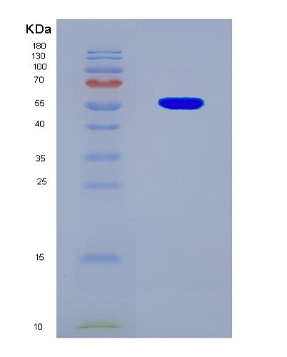 SDS-PAGE analysis of Human TP53 (Cellular Tumor Antigen P53) - Recombinant Protein, CATHuman TP53 (Cellular Tumor Antigen P53) - Recombinant Protein