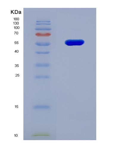 SDS-PAGE analysis of Human CYP17A1 (Steroid 17-Alpha-Hydroxylase/17,20 Lyase) - Recombinant Protein, CAT# BLT-08703P showing >90% purity under 15% SDS-PAGE (Reduced)Human CYP17A1 (Steroid 17-Alpha-Hydroxylase/17,20 Lyase) - Recombinant Protein