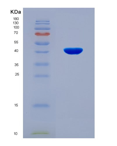 SDS-PAGE analysis of Human PRKACA (Camp-Dependent Protein Kinase Catalytic Subunit Alpha) - Recombinant Protein, CATHuman PRKACA (Camp-Dependent Protein Kinase Catalytic Subunit Alpha) - Recombinant Protein