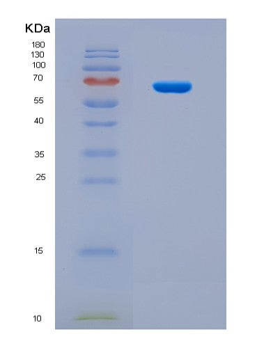SDS-PAGE analysis of Human CYP19A1 (Aromatase) - Recombinant Protein, CATHuman CYP19A1 (Aromatase) - Recombinant Protein