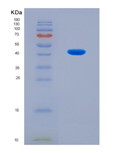 SDS-PAGE analysis of Human ACAT1 (Acetyl-Coa Acetyltransferase, Mitochondrial) - Recombinant Protein, CATHuman ACAT1 (Acetyl-Coa Acetyltransferase, Mitochondrial) - Recombinant Protein