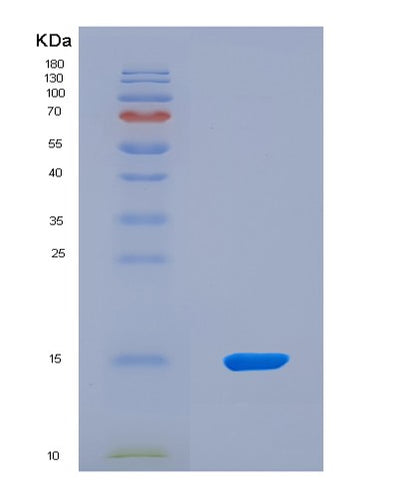 SDS-PAGE analysis of Mouse Ffar1 (Free Fatty Acid Receptor 1) - Recombinant Protein, CAT# BLT-08711P showing >90% purity under 15% SDS-PAGE (Reduced)Mouse Ffar1 (Free Fatty Acid Receptor 1) - Recombinant Protein