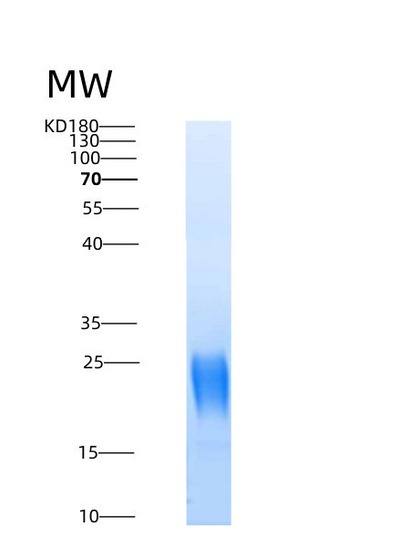 SDS-PAGE analysis of Mouse Il5 (Interleukin-5) - Recombinant Protein, CAT# BLT-08712P showing >90% purity under 15% SDS-PAGE (Reduced)Mouse Il5 (Interleukin-5) - Recombinant Protein