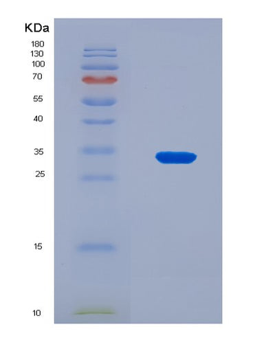 SDS-PAGE analysis of Human FCGRT (Igg Receptor Fcrn Large Subunit P51) - Recombinant Protein, CAT# BLT-08713P showing >90% purity under 15% SDS-PAGE (Reduced)Human FCGRT (Igg Receptor Fcrn Large Subunit P51) - Recombinant Protein