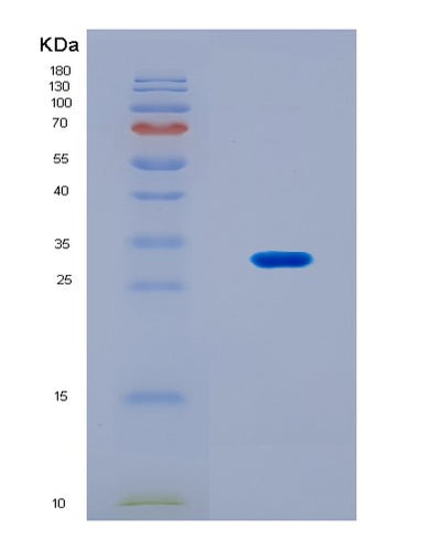 SDS-PAGE analysis of Human HLA-DQB1 (Hla Class Ii Histocompatibility Antigen, Dq Beta 1 Chain) - Recombinant Protein, CAT# BLT-08716P showing >90% purity under 15% SDS-PAGE (Reduced)Human HLA-DQB1 (Hla Class Ii Histocompatibility Antigen, Dq Beta 1 Chain) - Recombinant Protein