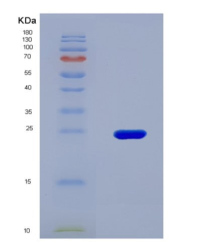 SDS-PAGE analysis of Human IL32 (Interleukin-32) - Recombinant Protein, CATHuman IL32 (Interleukin-32) - Recombinant Protein