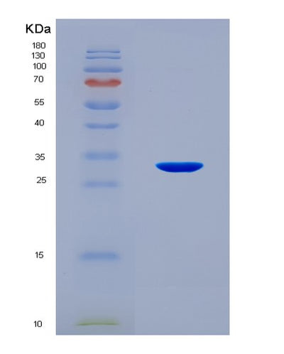 SDS-PAGE analysis of Human IDE (Insulin-Degrading Enzyme) - Recombinant Protein, CAT# BLT-08720P showing >90% purity under 15% SDS-PAGE (Reduced)Human IDE (Insulin-Degrading Enzyme) - Recombinant Protein
