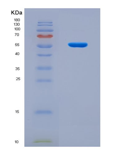 SDS-PAGE analysis of Human CRTC2 (Creb-Regulated Transcription Coactivator 2) - Recombinant Protein, CAT# BLT-08724P showing >90% purity under 15% SDS-PAGE (Reduced)Human CRTC2 (Creb-Regulated Transcription Coactivator 2) - Recombinant Protein