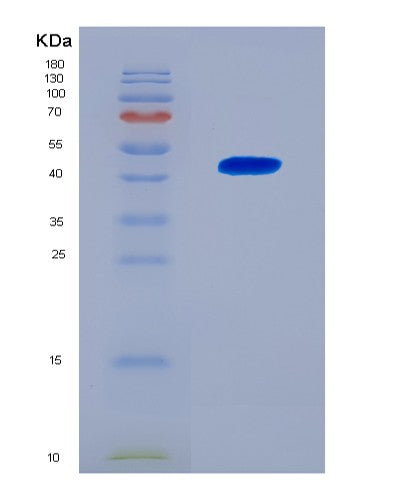 SDS-PAGE analysis of Human MAPK3 (Mitogen-Activated Protein Kinase 3) - Recombinant Protein, CATHuman MAPK3 (Mitogen-Activated Protein Kinase 3) - Recombinant Protein