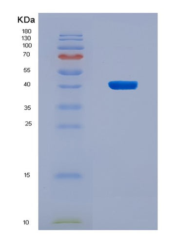 SDS-PAGE analysis of Human WNT6 (Protein Wnt-6) - Recombinant Protein, CAT# BLT-08727P showing >90% purity under 15% SDS-PAGE (Reduced)Human WNT6 (Protein Wnt-6) - Recombinant Protein