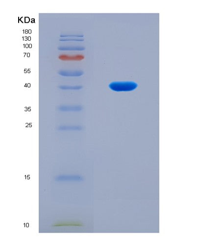 SDS-PAGE analysis of Human C5 (Complement C5) - Recombinant Protein, CATHuman C5 (Complement C5) - Recombinant Protein