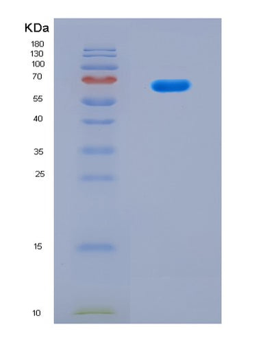 SDS-PAGE analysis of Human EPHX1 (Epoxide Hydrolase 1) - Recombinant Protein, CAT# BLT-08737P showing >90% purity under 15% SDS-PAGE (Reduced)Human EPHX1 (Epoxide Hydrolase 1) - Recombinant Protein