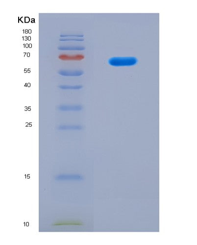 SDS-PAGE analysis of Human EPHX1 (Epoxide Hydrolase 1) - Recombinant Protein, CATHuman EPHX1 (Epoxide Hydrolase 1) - Recombinant Protein