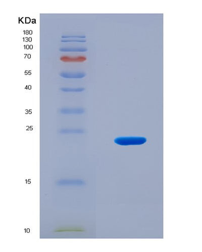 SDS-PAGE analysis of Mouse Grem1 (Gremlin-1) - Recombinant Protein, CAT# BLT-08738P showing >90% purity under 15% SDS-PAGE (Reduced)Mouse Grem1 (Gremlin-1) - Recombinant Protein
