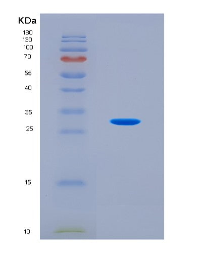 SDS-PAGE analysis of Mouse Gls (Glutaminase Kidney Isoform, Mitochondrial) - Recombinant Protein, CATMouse Gls (Glutaminase Kidney Isoform, Mitochondrial) - Recombinant Protein