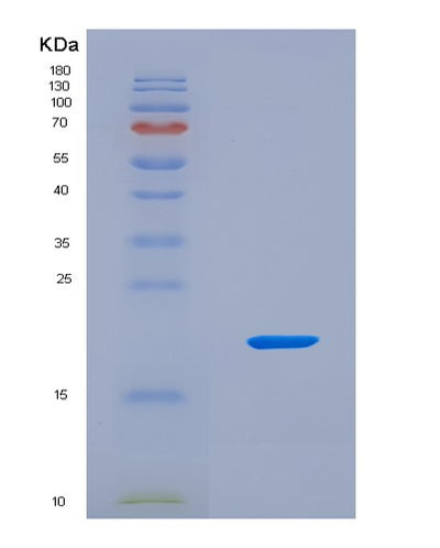 SDS-PAGE analysis of Human RPS23 (Small Ribosomal Subunit Protein Us12) - Recombinant Protein, CAT# BLT-08743P showing >90% purity under 15% SDS-PAGE (Reduced)Human RPS23 (Small Ribosomal Subunit Protein Us12) - Recombinant Protein