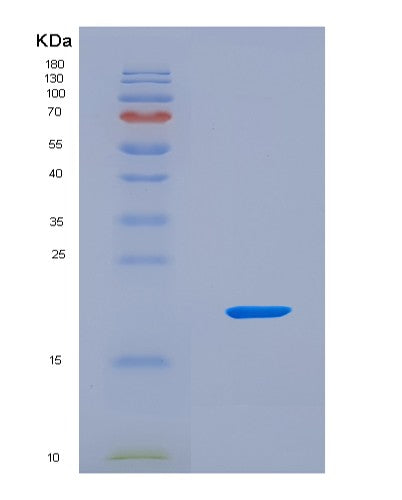 SDS-PAGE analysis of Human RPS23 (Small Ribosomal Subunit Protein Us12) - Recombinant Protein, CATHuman RPS23 (Small Ribosomal Subunit Protein Us12) - Recombinant Protein
