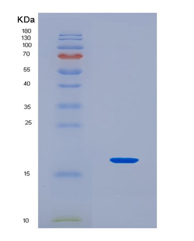 SDS-PAGE analysis of Human FAU (Ubiquitin-Like Fubi-Ribosomal Protein Es30 Fusion Protein) - Recombinant Protein, CAT# BLT-08744P showing >90% purity under 15% SDS-PAGE (Reduced)Human FAU (Ubiquitin-Like Fubi-Ribosomal Protein Es30 Fusion Protein) - Recombinant Protein