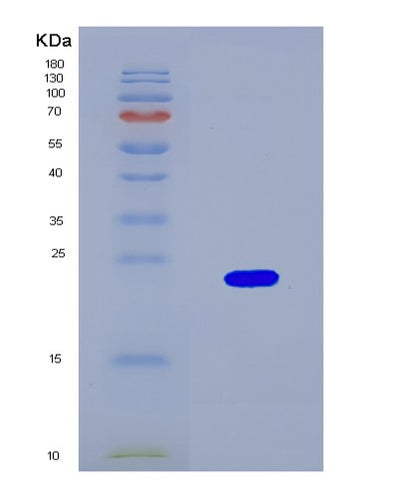 SDS-PAGE analysis of Human D2HGDH (D-2-Hydroxyglutarate Dehydrogenase, Mitochondrial) - Recombinant Protein, CAT# BLT-08745P showing >90% purity under 15% SDS-PAGE (Reduced)Human D2HGDH (D-2-Hydroxyglutarate Dehydrogenase, Mitochondrial) - Recombinant Protein