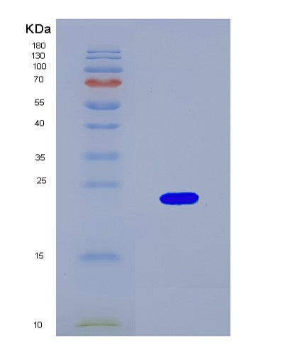 SDS-PAGE analysis of Human D2HGDH (D-2-Hydroxyglutarate Dehydrogenase, Mitochondrial) - Recombinant Protein, CATHuman D2HGDH (D-2-Hydroxyglutarate Dehydrogenase, Mitochondrial) - Recombinant Protein