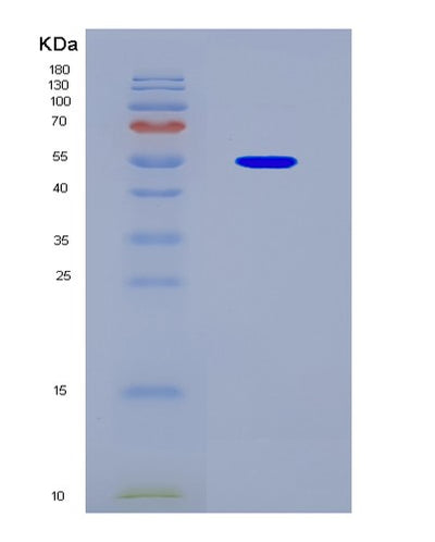 SDS-PAGE analysis of Human D2HGDH (D-2-Hydroxyglutarate Dehydrogenase, Mitochondrial) - Recombinant Protein, CAT# BLT-08746P showing >90% purity under 15% SDS-PAGE (Reduced)Human D2HGDH (D-2-Hydroxyglutarate Dehydrogenase, Mitochondrial) - Recombinant Protein