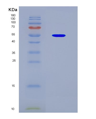 SDS-PAGE analysis of Human D2HGDH (D-2-Hydroxyglutarate Dehydrogenase, Mitochondrial) - Recombinant Protein, CATHuman D2HGDH (D-2-Hydroxyglutarate Dehydrogenase, Mitochondrial) - Recombinant Protein
