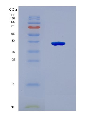 SDS-PAGE analysis of Human GBP5 (Guanylate-Binding Protein 5) - Recombinant Protein, CATHuman GBP5 (Guanylate-Binding Protein 5) - Recombinant Protein