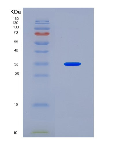 SDS-PAGE analysis of Human (Line-1 Retrotransposable Element Orf2 Protein) - Recombinant Protein, CATHuman (Line-1 Retrotransposable Element Orf2 Protein) - Recombinant Protein