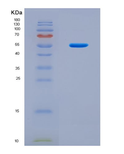 SDS-PAGE analysis of Human TNFSF11 (Tumor Necrosis Factor Ligand Superfamily Member 11) - Recombinant Protein, CAT# BLT-08751P showing >85% purity under 15% SDS-PAGE (Reduced)Human TNFSF11 (Tumor Necrosis Factor Ligand Superfamily Member 11) - Recombinant Protein
