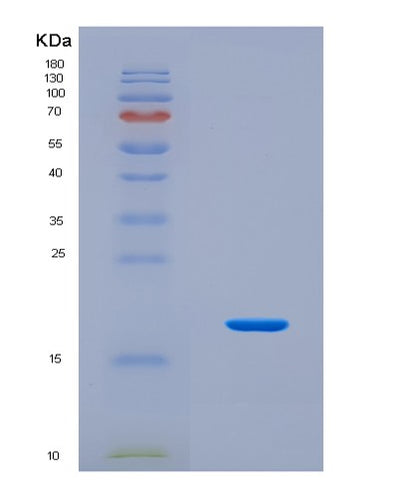 SDS-PAGE analysis of Human COMP (Cartilage Oligomeric Matrix Protein) - Recombinant Protein, CAT# BLT-08753P showing >90% purity under 15% SDS-PAGE (Reduced)Human COMP (Cartilage Oligomeric Matrix Protein) - Recombinant Protein
