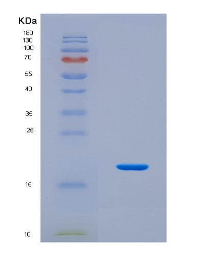 SDS-PAGE analysis of Human COMP (Cartilage Oligomeric Matrix Protein) - Recombinant Protein, CATHuman COMP (Cartilage Oligomeric Matrix Protein) - Recombinant Protein