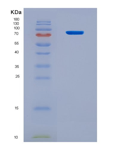 SDS-PAGE analysis of Human ACSL4 (Long-Chain-Fatty-Acid--Coa Ligase 4) - Recombinant Protein, CATHuman ACSL4 (Long-Chain-Fatty-Acid--Coa Ligase 4) - Recombinant Protein
