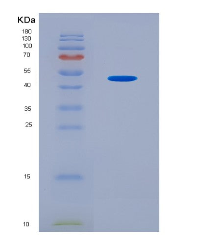 SDS-PAGE analysis of Mouse Dbt (Lipoamide Acyltransferase Component Of Branched-Chain Alpha-Keto Acid Dehydrogenase Complex, Mitochondrial) - Recombinant Protein, CATMouse Dbt (Lipoamide Acyltransferase Component Of Branched-Chain Alpha-Keto Acid Dehydrogenase Complex, Mitochondrial) - Recombinant Protein