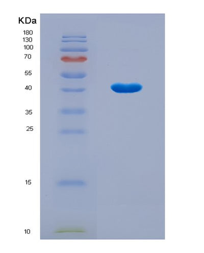 SDS-PAGE analysis of Human NEU1 (Sialidase-1) - Recombinant Protein, CAT# BLT-08759P showing >90% purity under 15% SDS-PAGE (Reduced)Human NEU1 (Sialidase-1) - Recombinant Protein