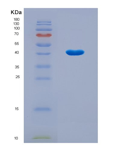 SDS-PAGE analysis of Human NEU1 (Sialidase-1) - Recombinant Protein, CATHuman NEU1 (Sialidase-1) - Recombinant Protein