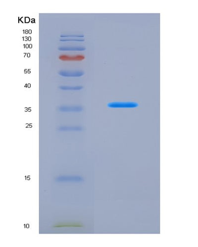 SDS-PAGE analysis of Human JAK2 (Tyrosine-Protein Kinase Jak2) - Recombinant Protein, CAT# BLT-08760P showing >90% purity under 15% SDS-PAGE (Reduced)Human JAK2 (Tyrosine-Protein Kinase Jak2) - Recombinant Protein