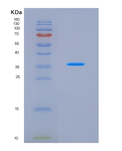 SDS-PAGE analysis of Human JAK2 (Tyrosine-Protein Kinase Jak2) - Recombinant Protein, CATHuman JAK2 (Tyrosine-Protein Kinase Jak2) - Recombinant Protein