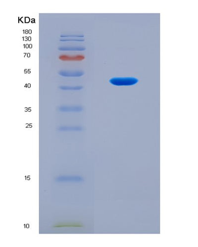 SDS-PAGE analysis of Mouse Bckdha (2-Oxoisovalerate Dehydrogenase Subunit Alpha, Mitochondrial) - Recombinant Protein, CAT# BLT-08757P showing >90% purity under 15% SDS-PAGE (Reduced)Mouse Bckdha (2-Oxoisovalerate Dehydrogenase Subunit Alpha, Mitochondrial) - Recombinant Protein