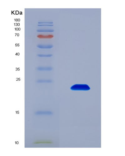 SDS-PAGE analysis of Human FAM20A (Pseudokinase Fam20A) - Recombinant Protein, CAT# BLT-08761P showing >90% purity under 15% SDS-PAGE (Reduced)Human FAM20A (Pseudokinase Fam20A) - Recombinant Protein