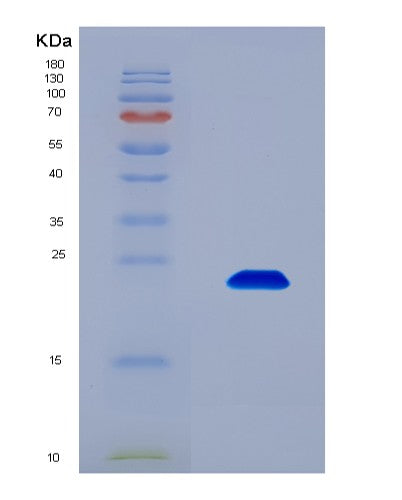 SDS-PAGE analysis of Human FAM20A (Pseudokinase Fam20A) - Recombinant Protein, CATHuman FAM20A (Pseudokinase Fam20A) - Recombinant Protein