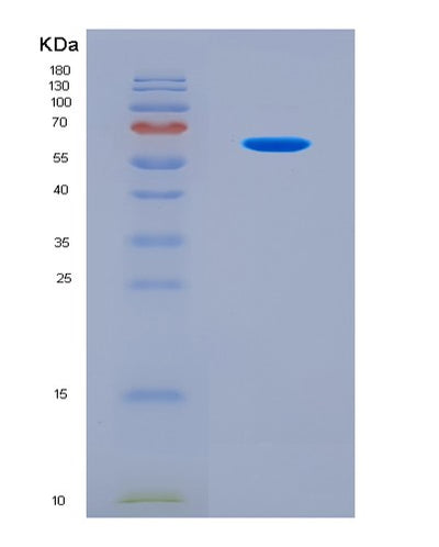 SDS-PAGE analysis of Mouse Ugp2 (Utp--Glucose-1-Phosphate Uridylyltransferase) - Recombinant Protein, CAT# BLT-08762P showing >90% purity under 15% SDS-PAGE (Reduced)Mouse Ugp2 (Utp--Glucose-1-Phosphate Uridylyltransferase) - Recombinant Protein
