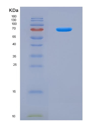 SDS-PAGE analysis of Human OAS1 (2'-5'-Oligoadenylate Synthase 1) - Recombinant Protein, CAT# BLT-08765P showing >90% purity under 15% SDS-PAGE (Reduced)Human OAS1 (2'-5'-Oligoadenylate Synthase 1) - Recombinant Protein