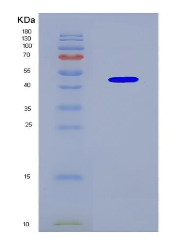 SDS-PAGE analysis of Human KCTD9 (Btb/Poz Domain-Containing Protein Kctd9) - Recombinant Protein, CAT# BLT-08766P showing >90% purity under 15% SDS-PAGE (Reduced)Human KCTD9 (Btb/Poz Domain-Containing Protein Kctd9) - Recombinant Protein